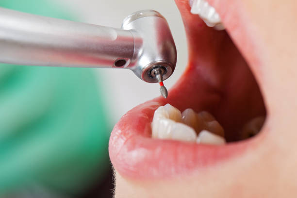 Best Weekend Emergency Dentist in Laurens, SC